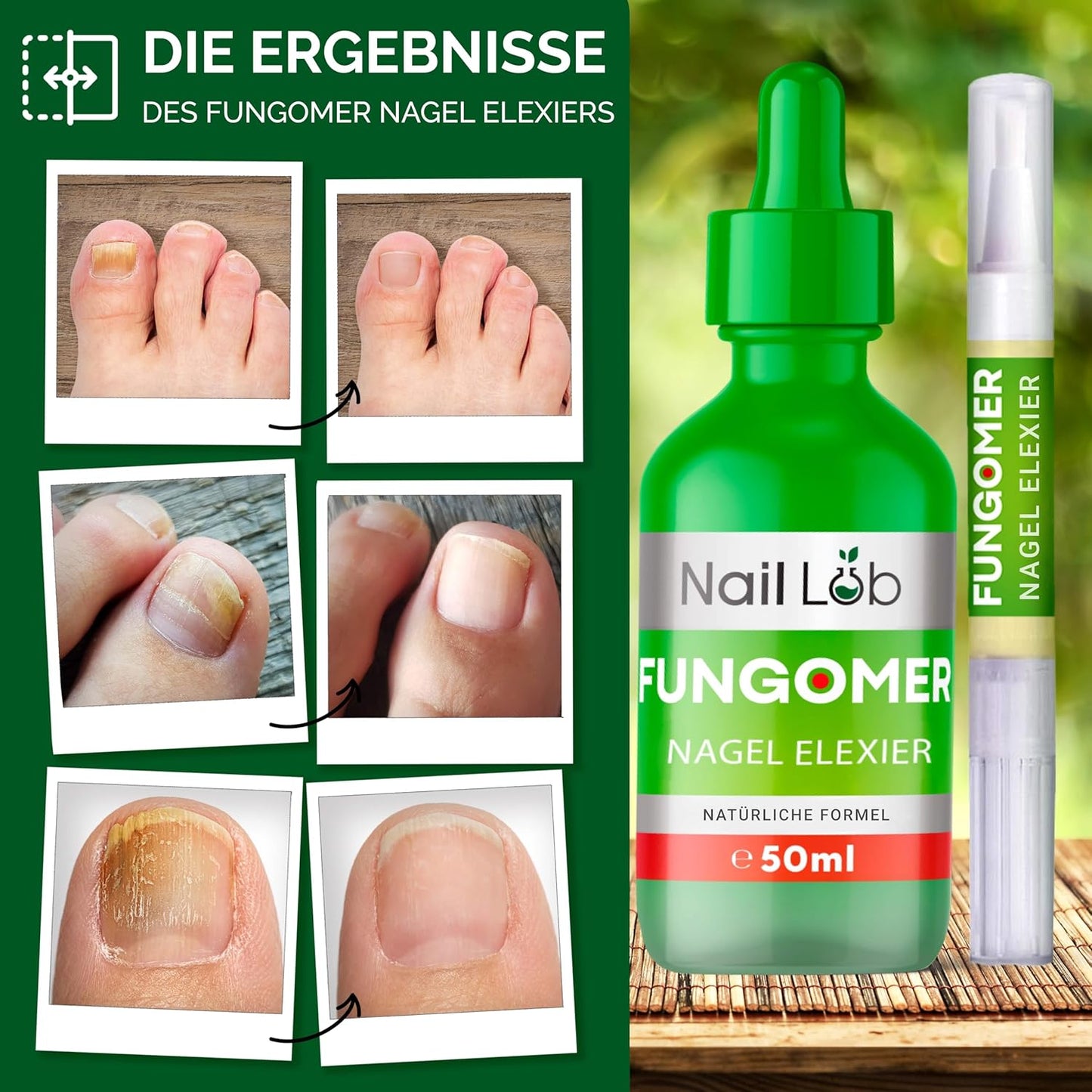 Fungomer Nagel-Elixier - Repariert Beschädigte Und Verfärbte Nägel - 50Ml - Enthält Teebaumöl, Geeignet Für Finger- Und Zehennägel Extra Stark - Kostenloser 3Ml Nagelstift + Nagelfeile