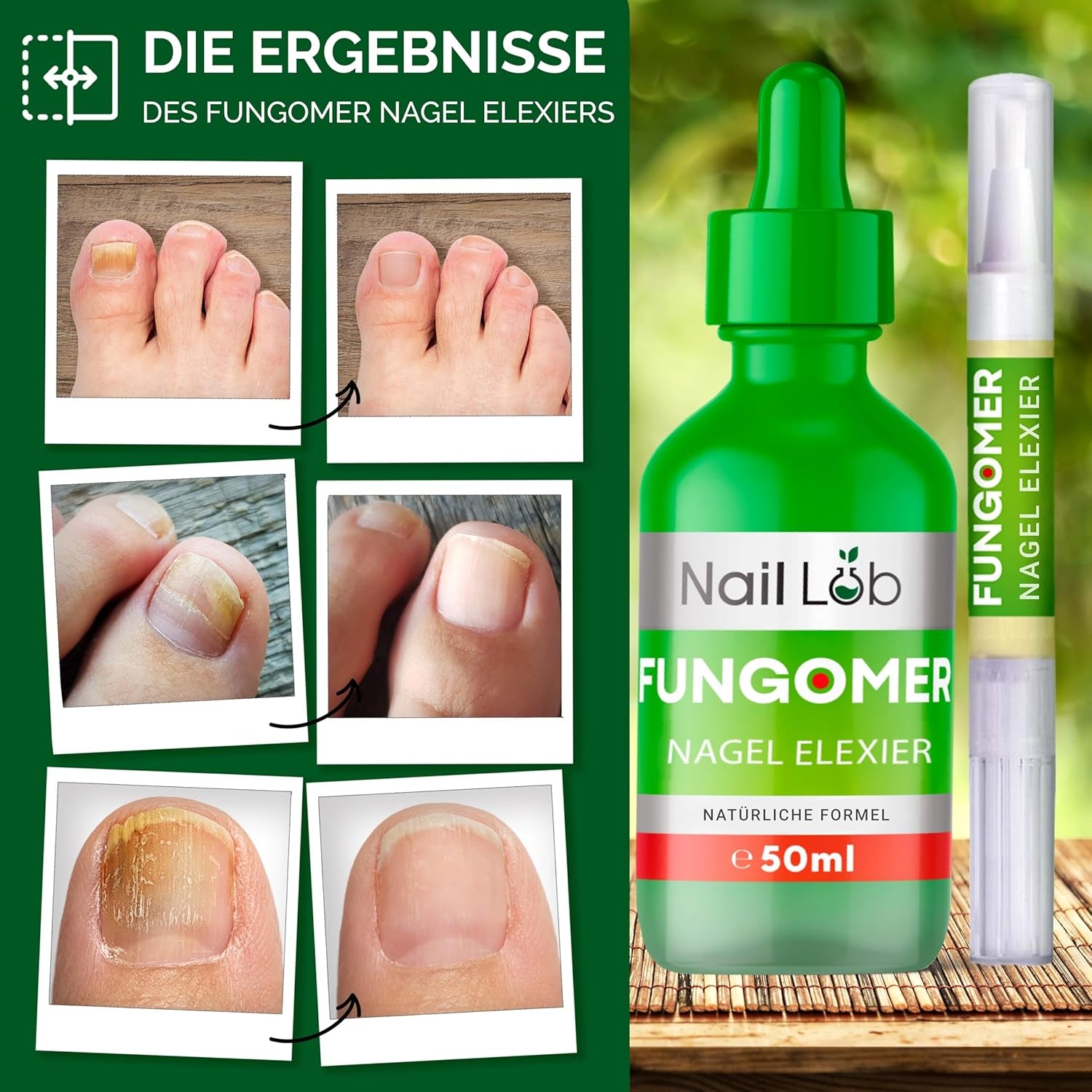 Fungomer Nagel-Elixier - Repariert Beschädigte Und Verfärbte Nägel - 50Ml - Enthält Teebaumöl, Geeignet Für Finger- Und Zehennägel Extra Stark - Kostenloser 3Ml Nagelstift + Nagelfeile