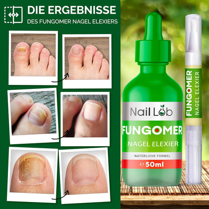 Fungomer Nagel-Elixier - Repariert Beschädigte Und Verfärbte Nägel - 50Ml - Enthält Teebaumöl, Geeignet Für Finger- Und Zehennägel Extra Stark - Kostenloser 3Ml Nagelstift + Nagelfeile